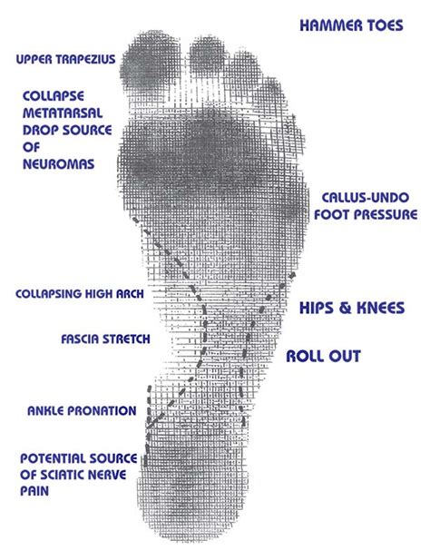 Common Varieties of Foot Irregularities in Dreams