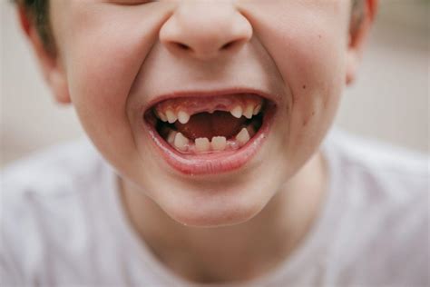 The Symbolism Behind Loose Teeth in Childhood