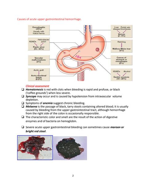  Exploring the Potential of Gastric Hemorrhage Revelations for Personal Development and Introspection 