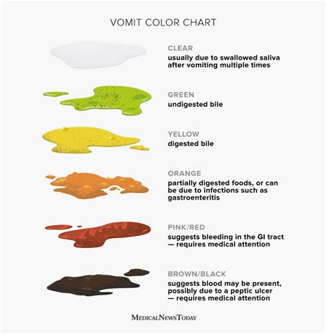  Exploring the Significance of Yellow Vomiting in Various Cultures and Traditions 