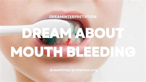  Historical and Cultural Interpretations of Dreams Involving Mouth Bleeding 