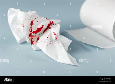  Interpretation of dreams involving blood on toilet paper 