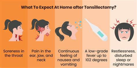  Postoperative Care: What to Expect After Tonsillectomy 