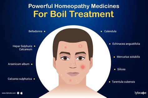  Relief is Within Reach: Treatment Options for Boils 