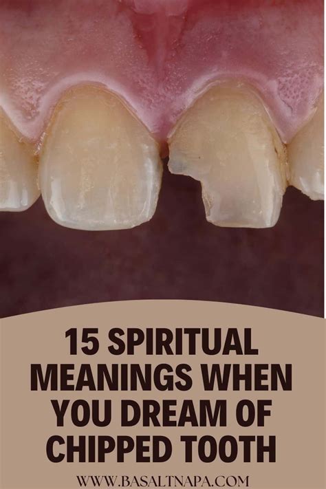  Revealing the Cultural and Spiritual Beliefs Associated with Dreams of Tooth Loss 