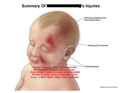 A Deeper Look into the Symbolism of Infants Experiencing Head Injuries