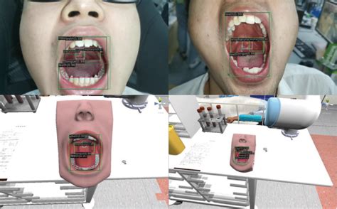 A Deeper Understanding of Objects Enclosed by the Oral Cavity in Dreams