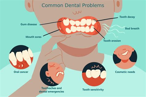 Addressing Common Oral Concerns and Techniques for Prevention