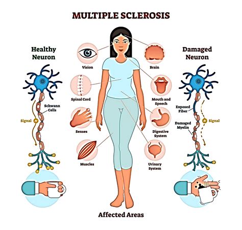 Age: How old is Ms Muscle?