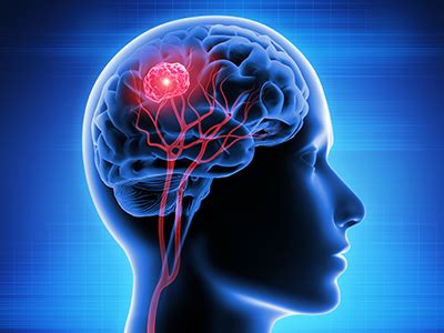 An Insight into Brain Tumors and Their Impact on Health