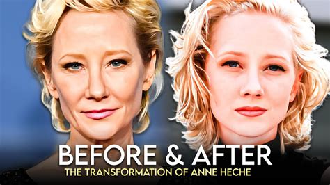 Anne Heche's Transformation Over the Years