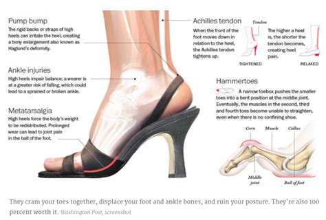 Avoiding Common Injuries Associated with Wearing High Heels
