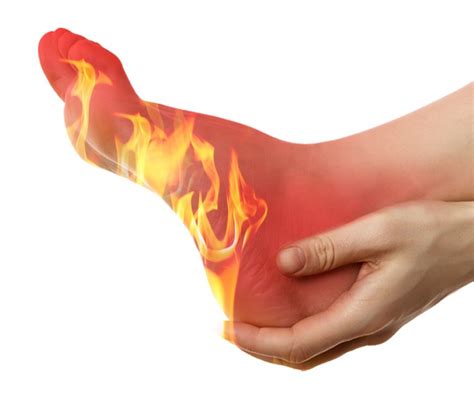 Burning Desires: Exploring the Link between Fiery Foot Dreams and Aspirations