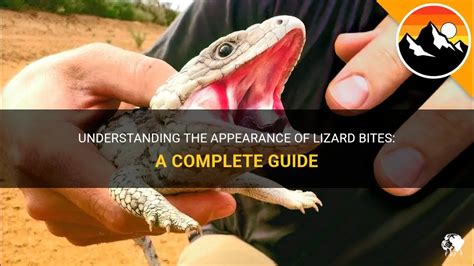 Common Emotions Associated with Experiences of Lizard Bites