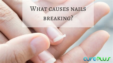 Common Themes and Meanings in Dreams of Nail Breakage