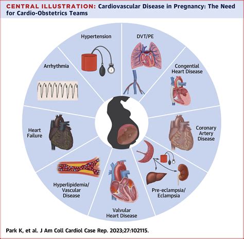 Concerning Dreams: Understanding the Significance of Maternal Cardiac Incidents