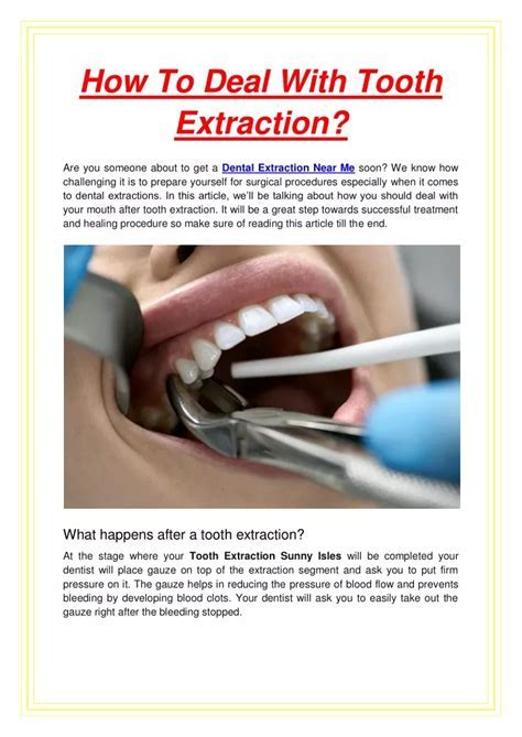 Coping Strategies for Dealing with Recurring Dreams about Tooth Extraction