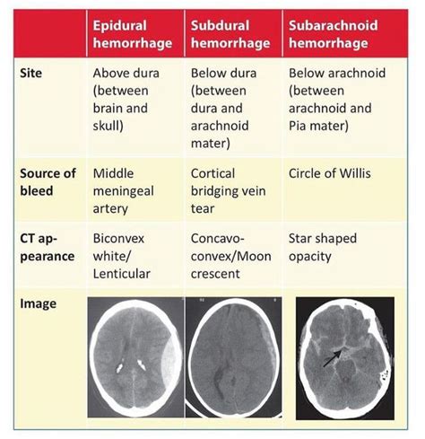 Coping Strategies for Dealing with Troubling Visions of Cranial Hemorrhage