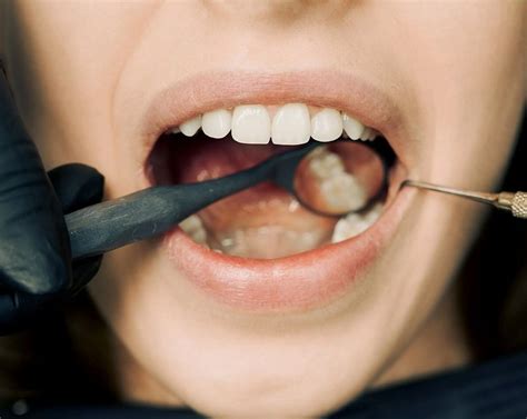 Could Dreams About Hair Lodged in Teeth Indicate Potential Dental Problems?