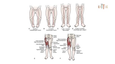 Cultural and Historical Significance of Lower Limbs