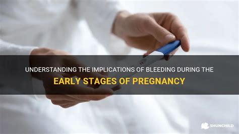 Deciphering Interpretations of Bleeding in the Initial Stages of Pregnancy