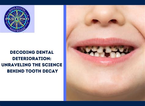 Deciphering Visions of Dental Deterioration: Unraveling the Symbolism Behind Tooth Loss