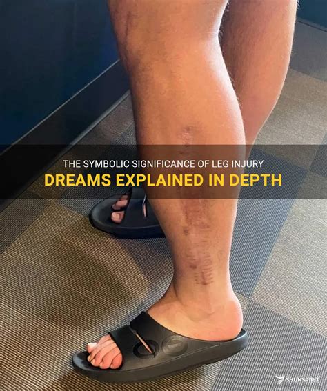 Deciphering the Symbolic Meanings within Dreams of an Injured Leg