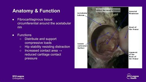 Decoding Interpretations of Limb Detachment in Relation to Personal Experiences