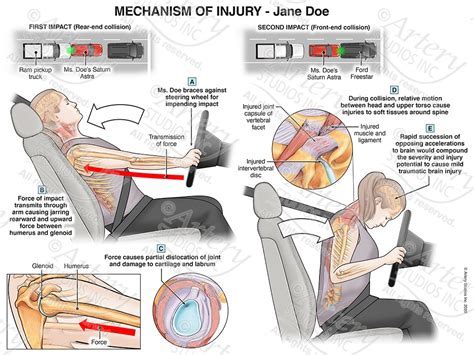 Decoding the Psychological Significance of Automotive Collisions in Dreams