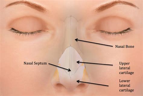 Decoding the Significance of Dreams Regarding the Displacement of Nasal Cartilage