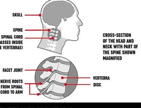 Decoding the Symbolism: Unveiling the Significance of a Neck Injury