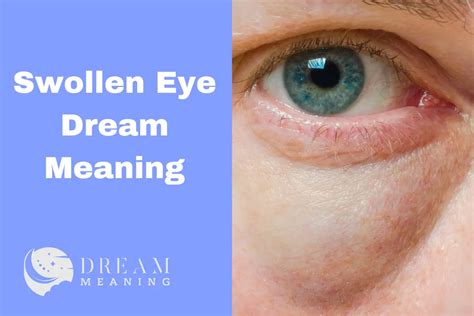 Decoding the Symbolism and Meanings of Puffy Eyes in Dreams