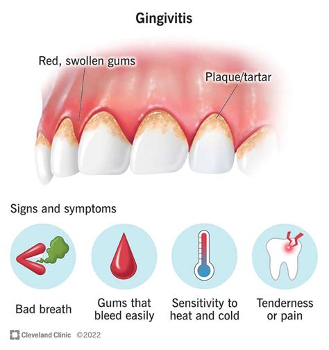 Decoding the Symbols: What Do gum infections in dreams Signify?