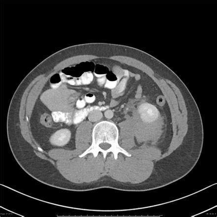 Delving into the Profound Analysis of Surgical Dreams Involving the Renal System