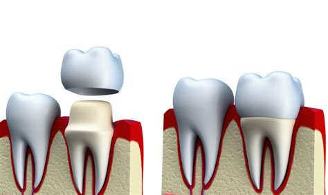 Dental and Medical Factors Influencing Abnormally Large Teeth