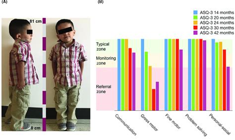 Details about the Number of Years Lived and Physical Stature of the Individual