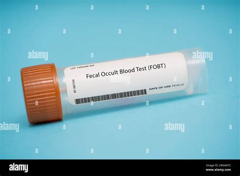 Detecting Presence of Blood in Stool: Gaining Insight into Contributing Factors and Potential Risks