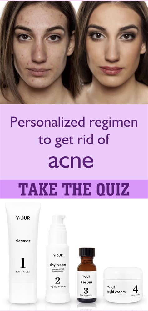 Developing a Personalized Skincare Routine for Skin Prone to Acne