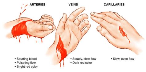 Different Types of Dreams Involving Bleeding on the Wrist