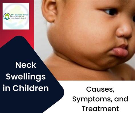 Distinguishing Unusual Neck Swelling: Understanding the Causes, Symptoms, and Treatment Options