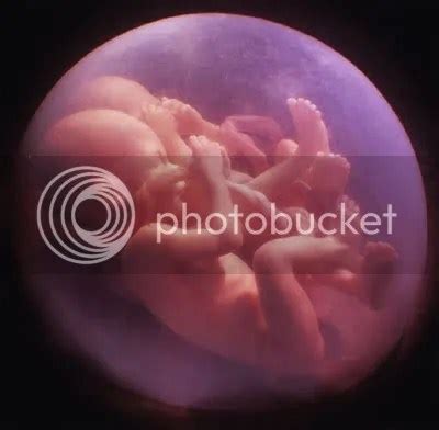 Diving into the Womb: Exploring the Fascinating World of Prenatal Ultrasound