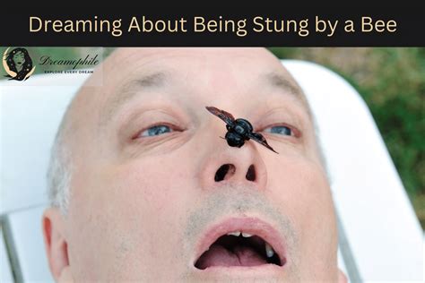 Dreaming of Being Stung: Facing Your Fears and Achieving Emotional Healing