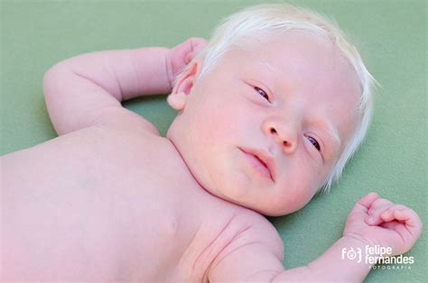 Dreaming of an Albino Child: A Message from the Unconscious Mind