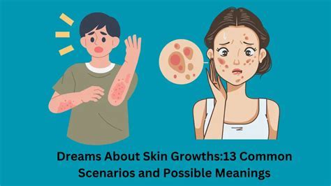 Dreams About Unpleasant Skin Growths: Understanding Their Symbolic Meaning