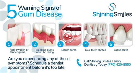 Dreams as Indicators: How Paying Attention to Your Dreams Can Help Identify Early Signs of Periodontal Disease