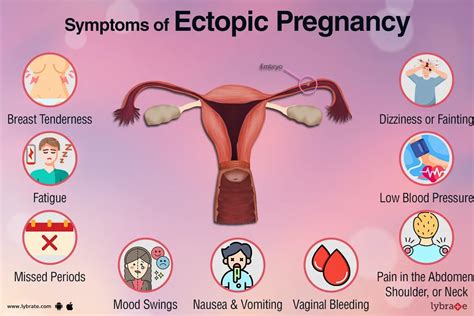 Ectopic Pregnancy and its Symptoms