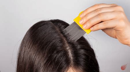 Effective Solutions to Eliminate Lice Infestations