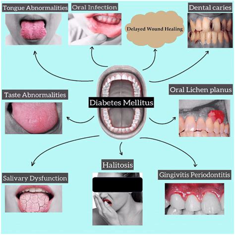 Effects on oral health and potential complications