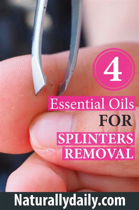 Essential Equipment for Splinter Extraction: A Comprehensive Checklist