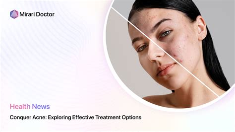 Exploring Effective Topical Treatments for Acne: